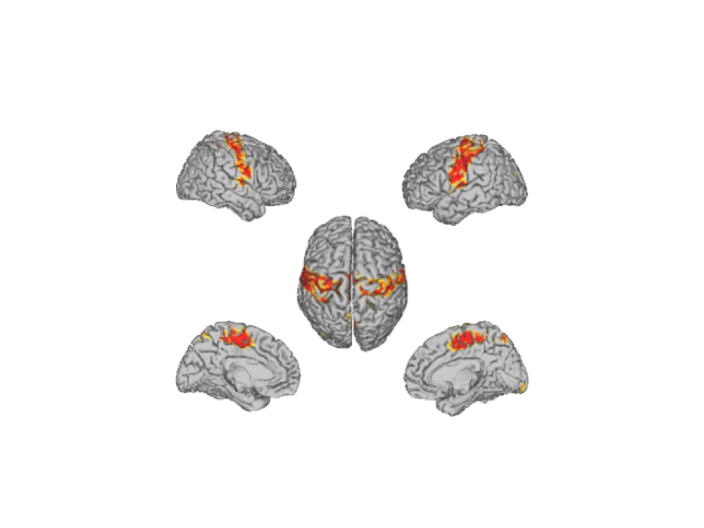 Electrophysiological brain resting state networks